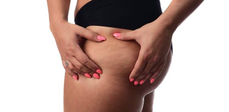 young-woman-showing-her-body-fat