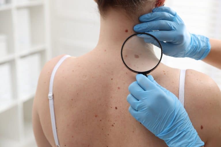 doctor-examining-woman-s-moles-in-hospita